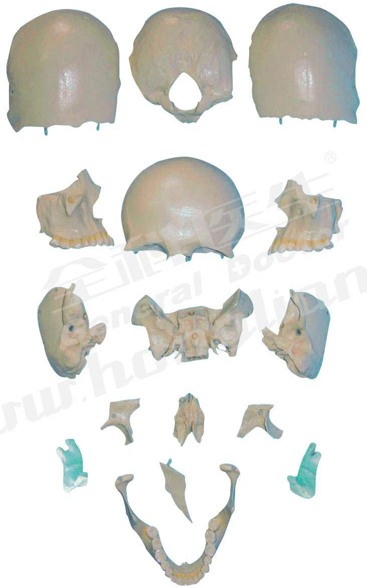 部分顱骨散骨模型A11117/2 