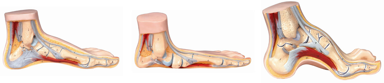 正常足、平底足、弓形足模型A11310 
