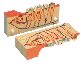 牙分解組織模型B10007 