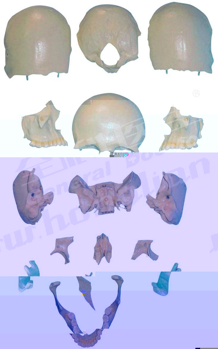 部分顱骨散骨模型A11117，分離頭顱骨散骨模型