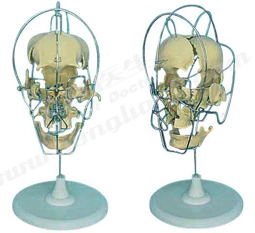 成人分離頭顱骨模型A11116/1，成人分離頭顱骨着色模型