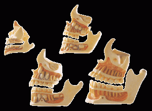 牙與颌骨的發育模型-是我公司自行研發生産熱銷的醫學教學模型,歡迎各醫院單位訂購021-63283651