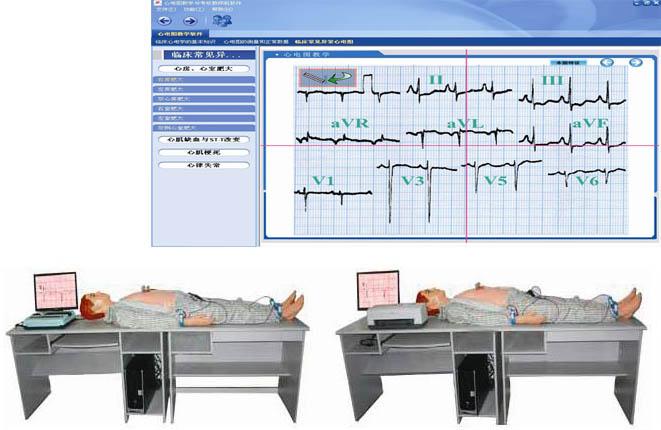 高智能數字網絡化心電圖模拟教學系統